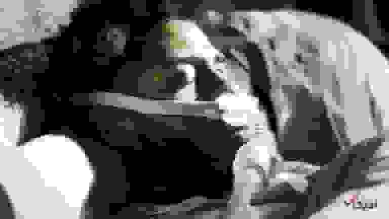 موفقیت ۹۳ درصدی روش نوین تحریک عصب هیپوگلوسال در درمان آپنه خواب