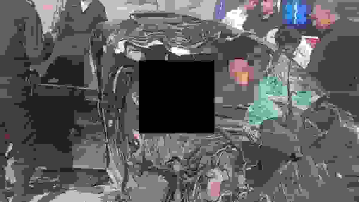 اهدای اعضای بدن دختر معاون رئیس‌جمهور پس از تصادف مرگبار