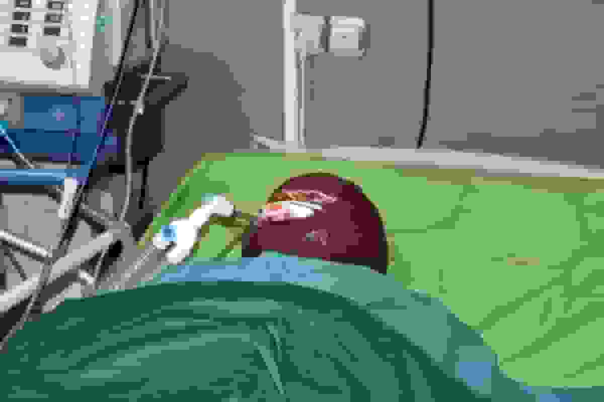 اسیدپاشی هولناک روی پدر و دختر در غرب تهران