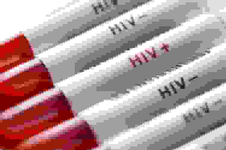 گسترش پایگاه‌های سیار اطلاع‌رسانی و آزمایش اچ‌آی‌وی در مشهد