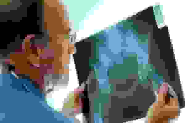 تشخیص و درمان آرتروز لگن با هوش مصنوعی توسط دانشگاه تهران