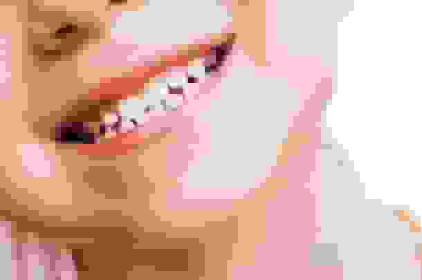 رحیمی: ۹۰ درصد کودکان ایرانی با دندان‌های پوسیده به مدرسه می‌روند