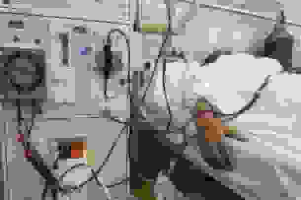 توصیه‌های ضروری برای افراد مبتلا به سنگ کلیه