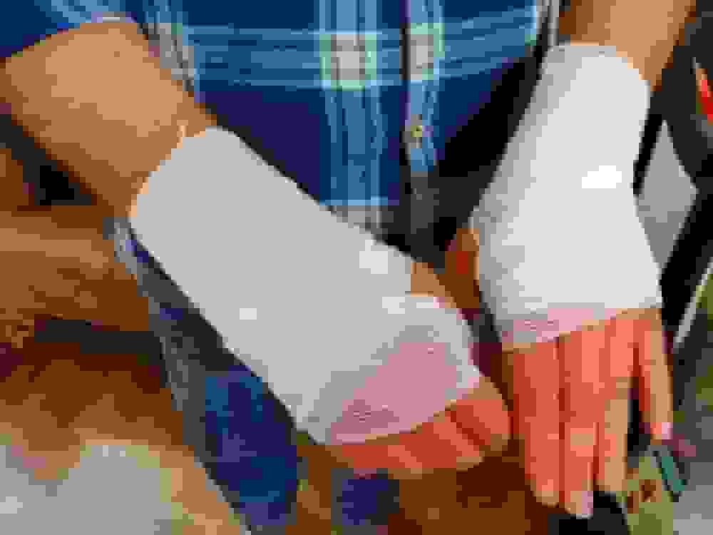 مرگ ۴۴ نفر در آذربایجان غربی بر اثر سوختگی در نیمه نخست سال