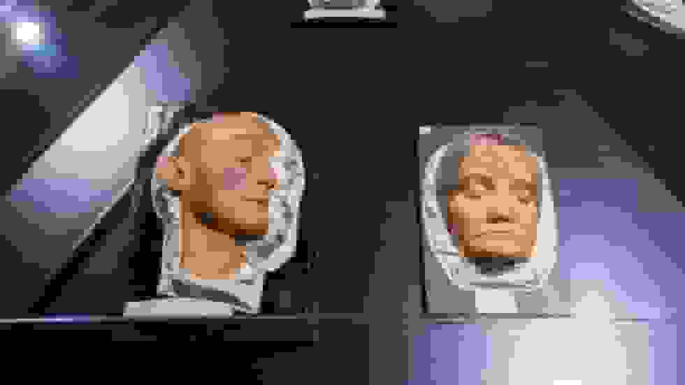 افزایش قابل توجه موارد سیفلیس در آلمان در سال ۲۰۲۴