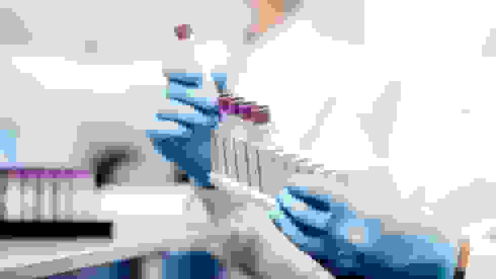 روسیه اولین دسته‌های آزمایشی واکسن سرطان را معرفی کرد