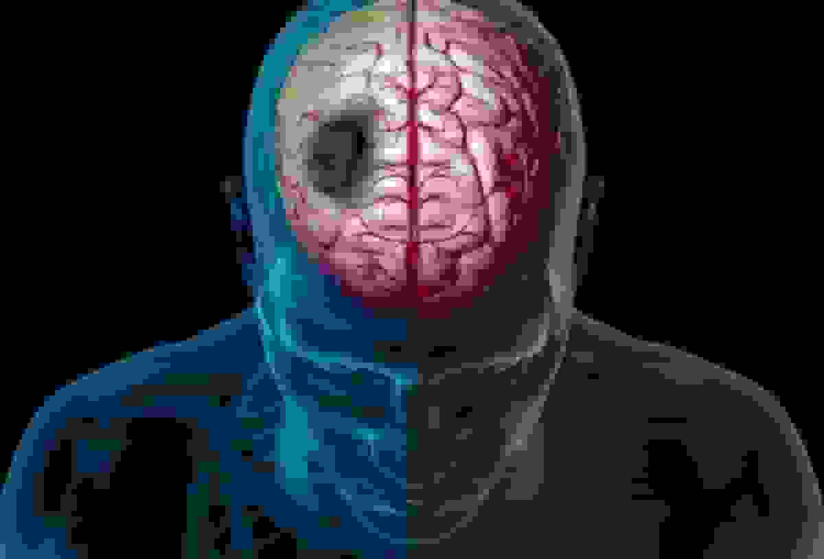 چگونه زمستان خطر سکته مغزی را افزایش می‌دهد؟