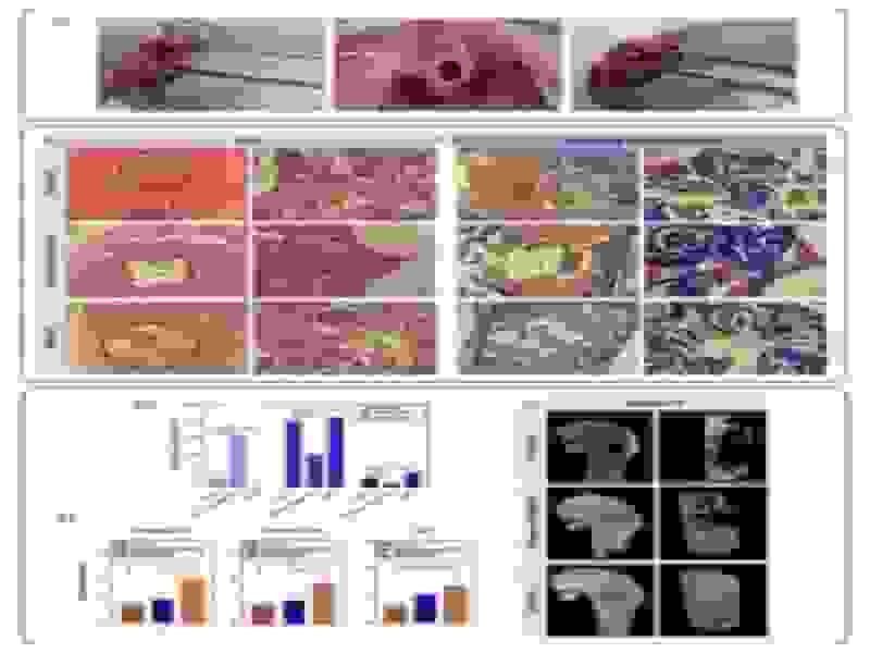 بهبود بازسازی استخوان با فناوری زیستی کم‌هزینه