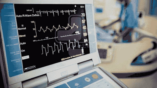 افزایش دقت پایش ضربان قلب در چهارمحال و بختیاری با نصب دستگاه الکتروفیزیولوژی