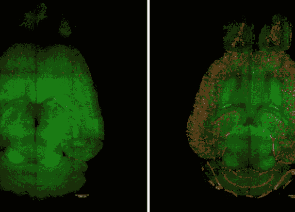 بازسازی سد خونی مغزی با نانو «سوئیچ» امید تازه‌ای برای درمان آلزایمر