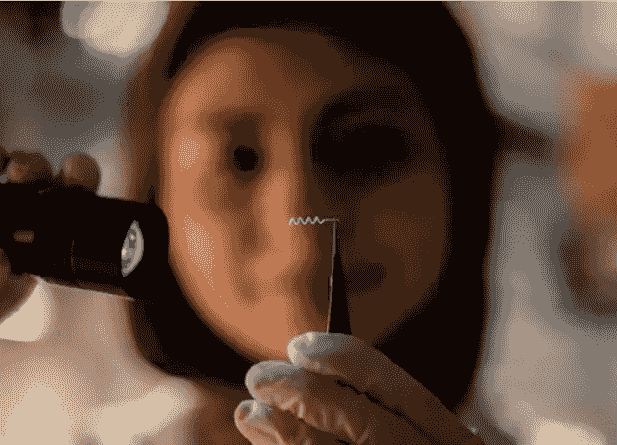 ایمپلنت انعطافپذیر برای درمان دقیقتر اختلالات مغزی