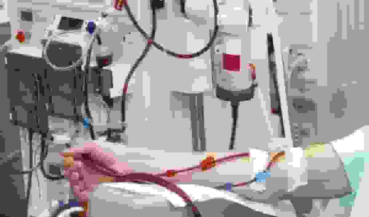 تحویل ۸۵ دستگاه دیالیز جدید به بیمارستان‌های هرمزگان