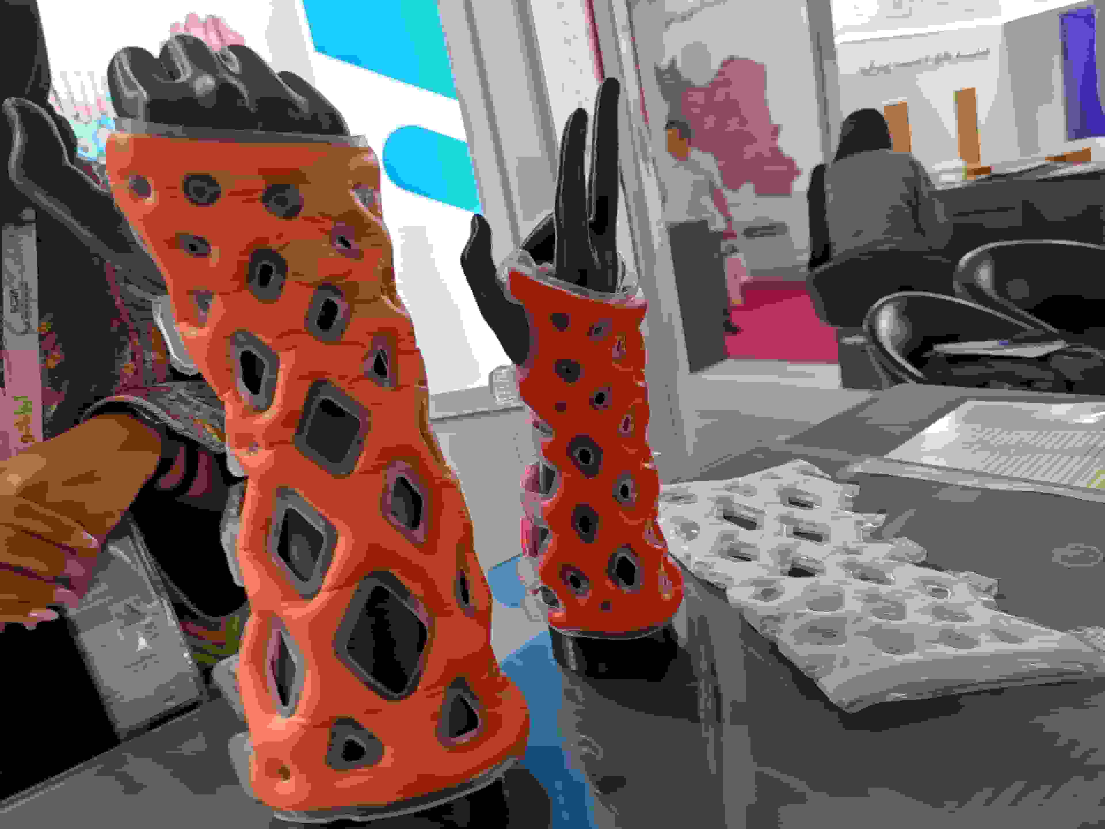 تولید گچ نانویی ضدآب و ضدحساسیت برای درمان شکستگی‌ها