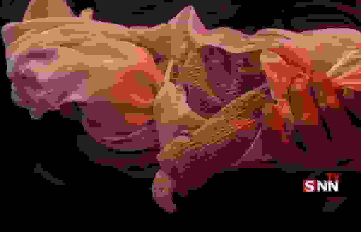 مرگ خاموش کودکان غزه با سلاح‌های نامرئی نسل‌کشی رژیم صهیونیستی