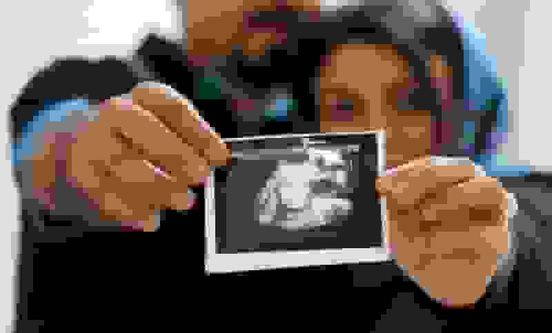 بیمه سلامت ۹۰ درصد مخارج درمان ناباروری را پرداخت می‌کند