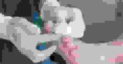 راه‌اندازی مرکز پلاسما‌درمانی زخم‌های دیابتی در بیمارستان امام علی (ع) کرج