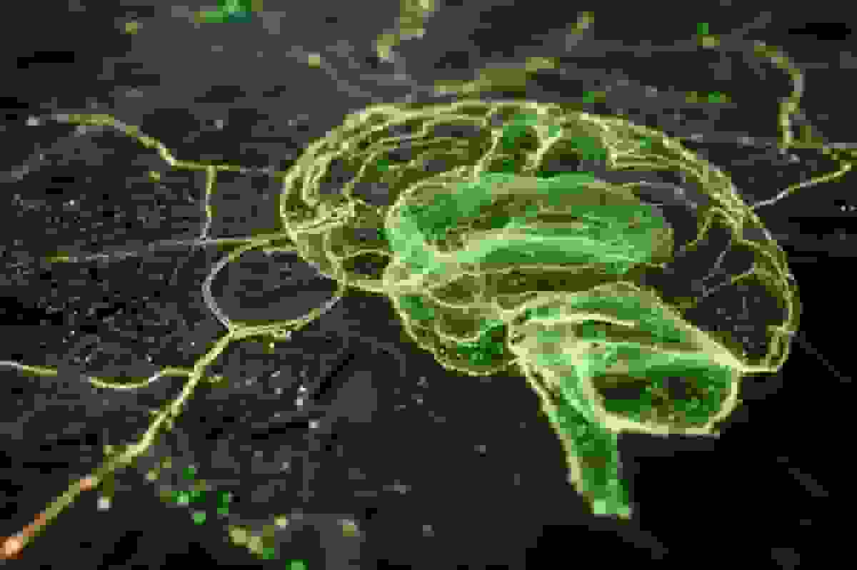 پژوهش جدید: تأثیر شرایط محل زندگی بر ریسک زوال عقل
