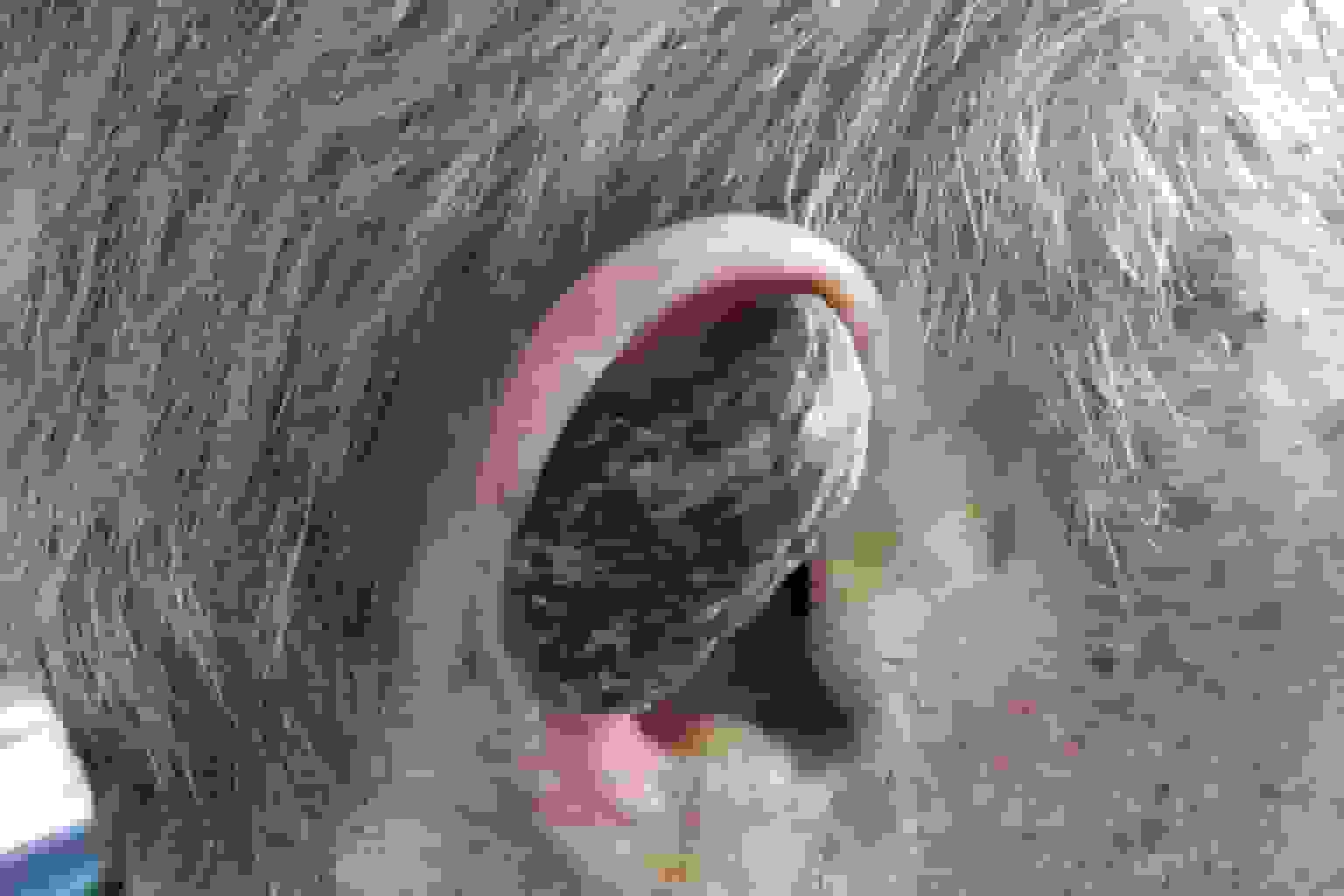 شاخ انسانی: عارضه پوستی نادر و علل رشد آن