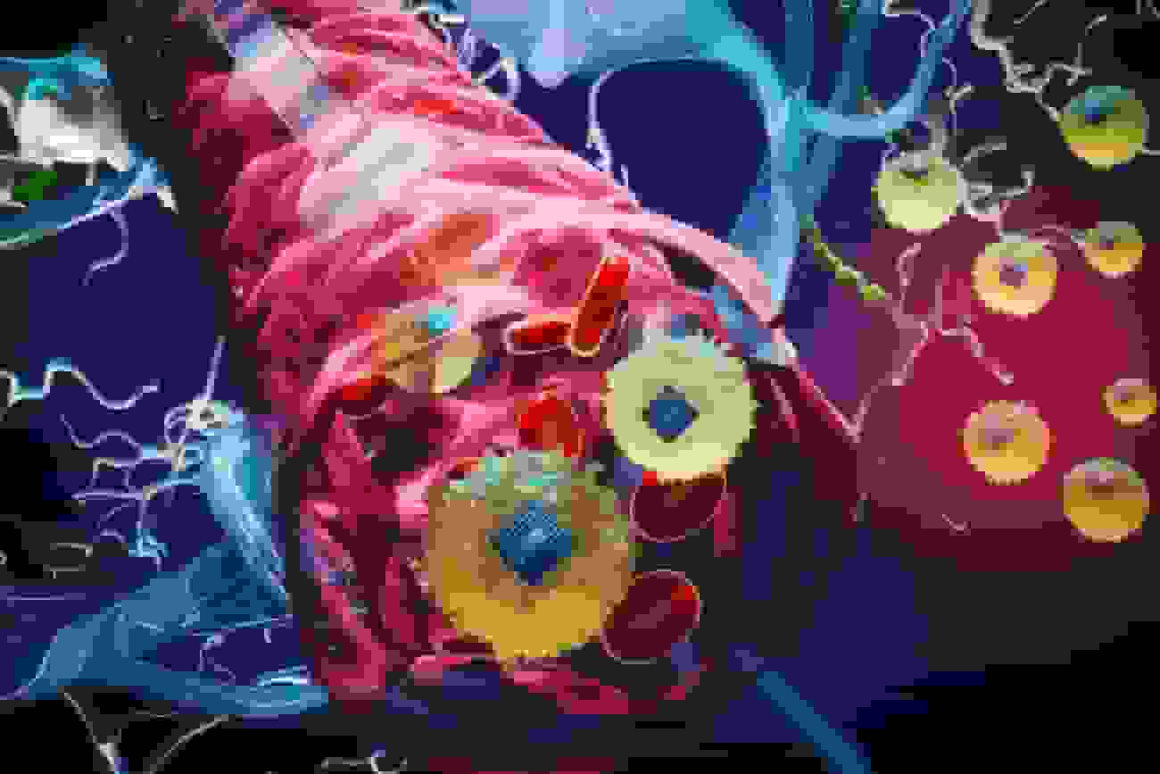 ابتکار دانشمندان MIT: درمان بیماری‌های مغزی بدون جراحی با تزریق ریزتراشه