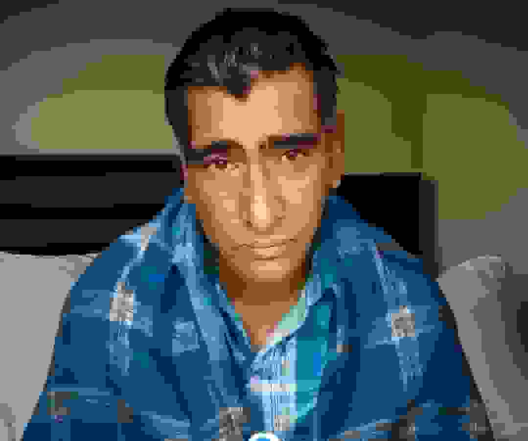 مرد هندی با اختلال نادر خواب؛ سالی ۳۰۰ روز در خواب