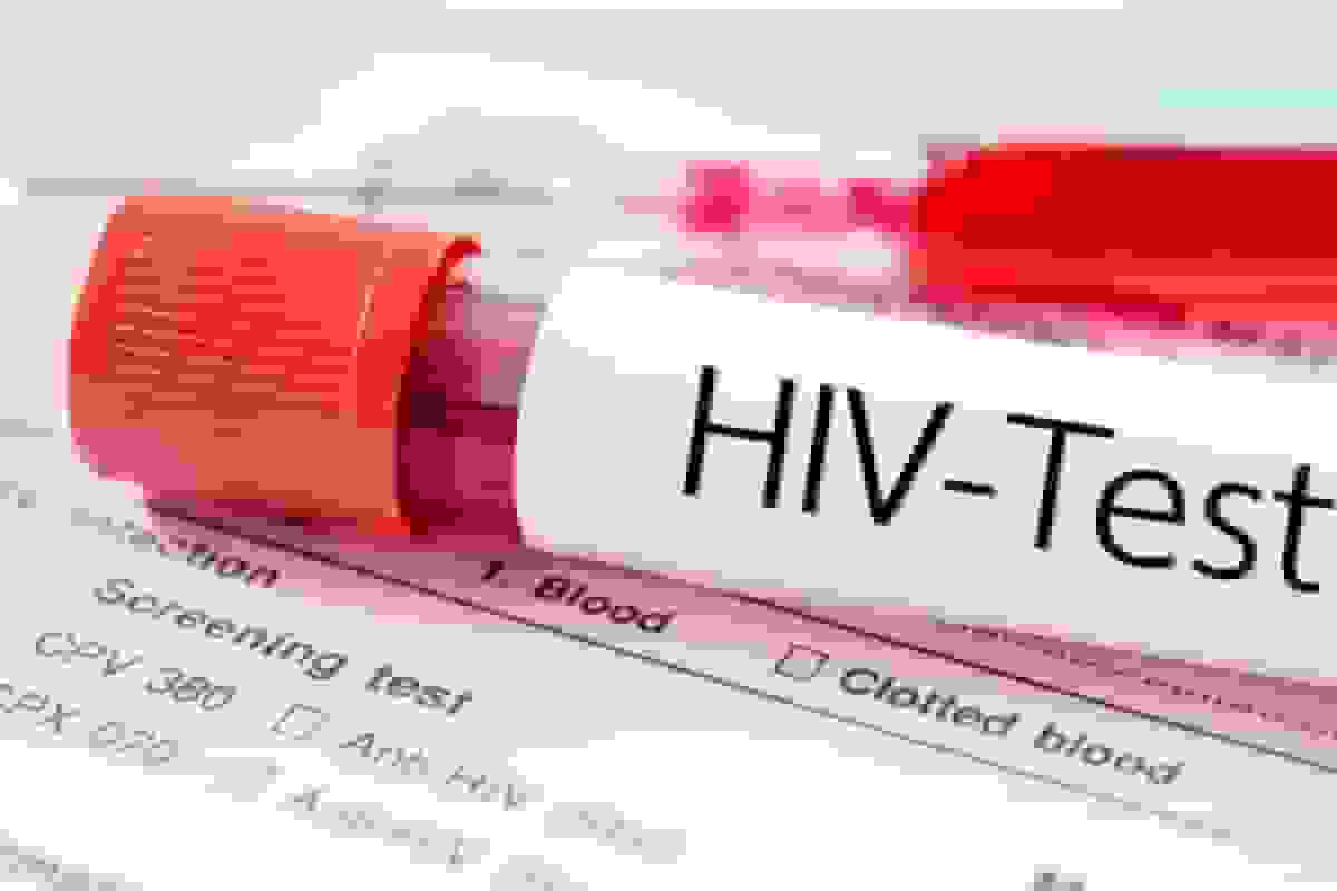 وزارت بهداشت: ۱۱ میلیون مبتلا به HIV در جهان/ هدف رساندن بیماریابی در ایران به ۸۰ درصد