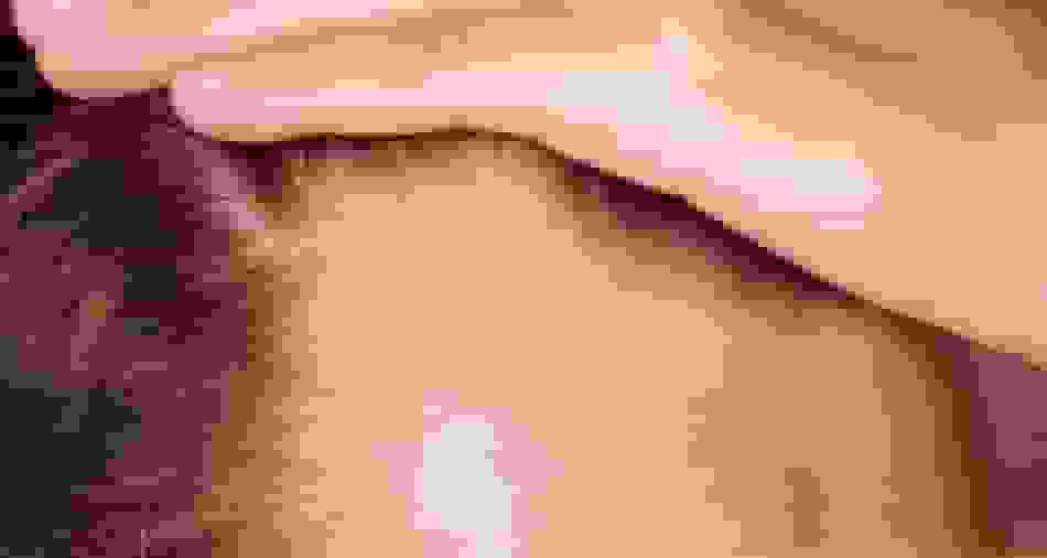 رشد ۵۳۹ درصدی مو با داروی جدید کلاسکوترون؛ انقلابی در درمان طاسی