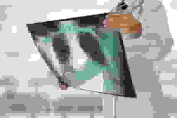 شناسایی ۱۷ مورد ابتلاء به بیماری سل در کاشان