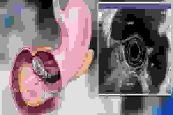 بیمارستان امام خمینی اردبیل به دستگاه پیشرفته اندوسونوگرافی مجهز شد