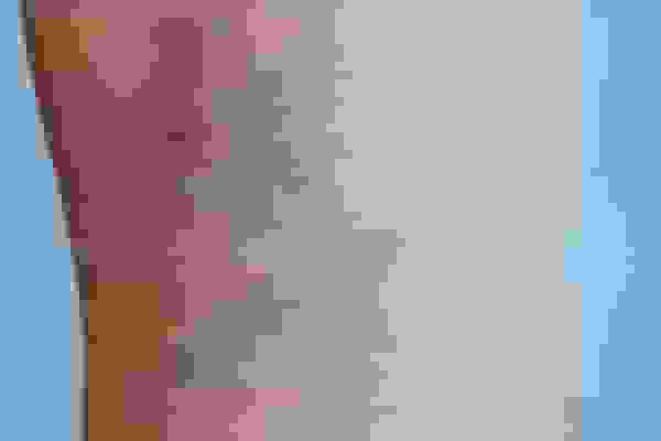 پیشگیری از واریس با چند عادت ساده