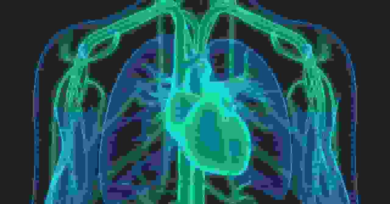 یک روش درمانی ویرایش ژن سطح کلسترول را به نصف کاهش داد