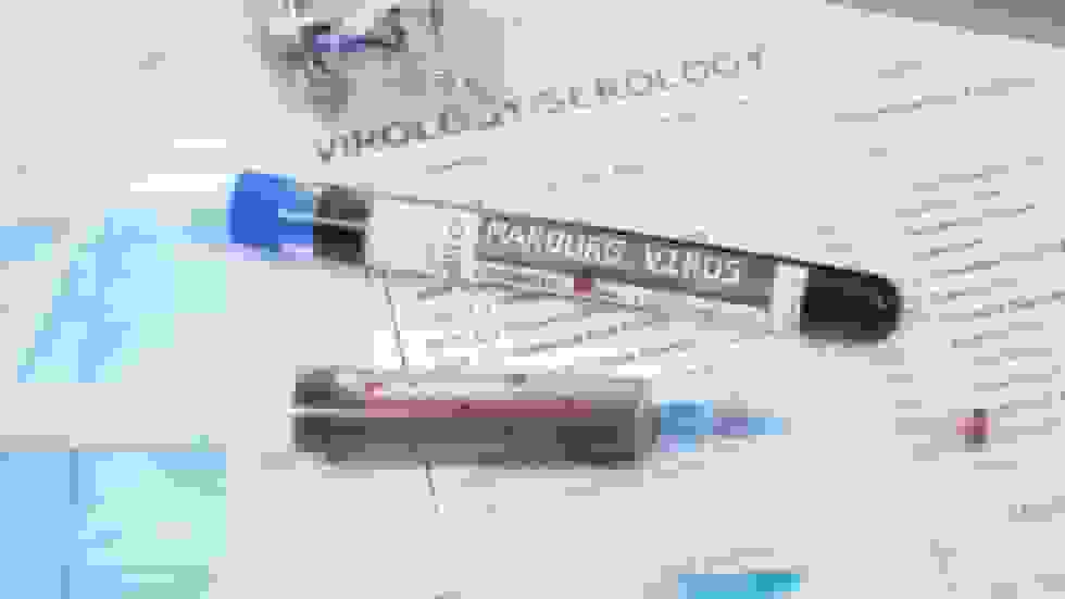 اتیوپی نخستین شیوع مرگبار ویروس ماربورگ را تأیید کرد