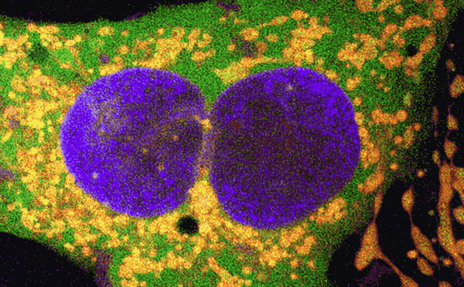 فناوری جدید ویرایش ژن برای درمان بیماریهای پیچیده ژنتیکی
