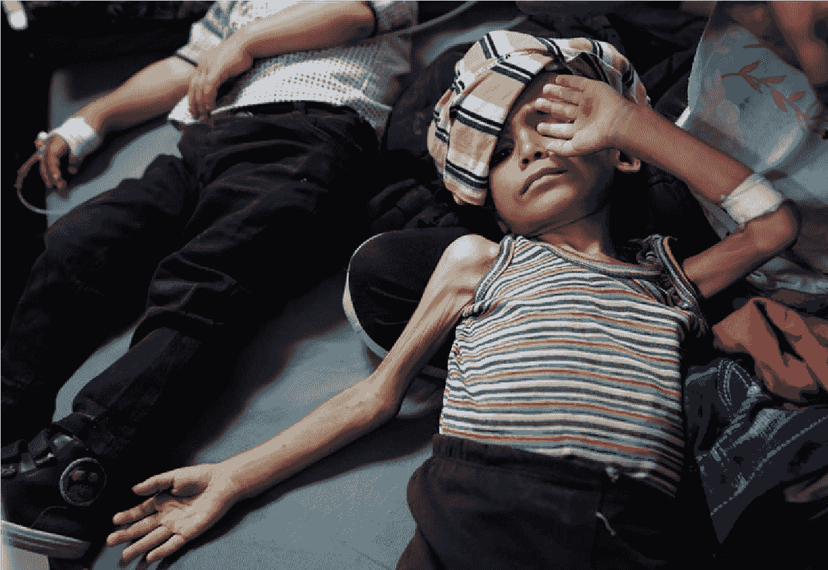 یونیسف: هزاران کودک در غزه از سوءتغذیه رنج میبرند