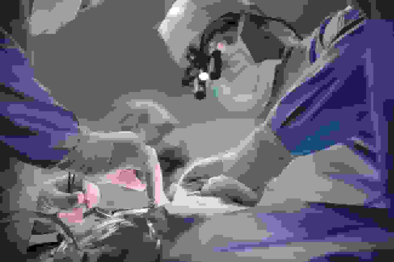 پیوند کبد خوک به انسان زنده توسط جراحان چینی