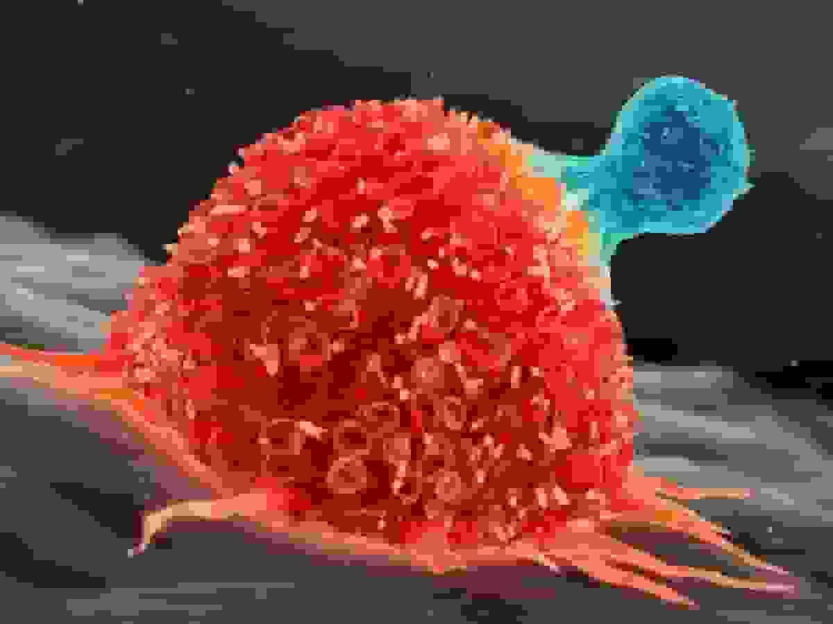 فعالسازی سلولهای T فرسوده برای مبارزه با سرطان توسط دانشمندان آمریکایی