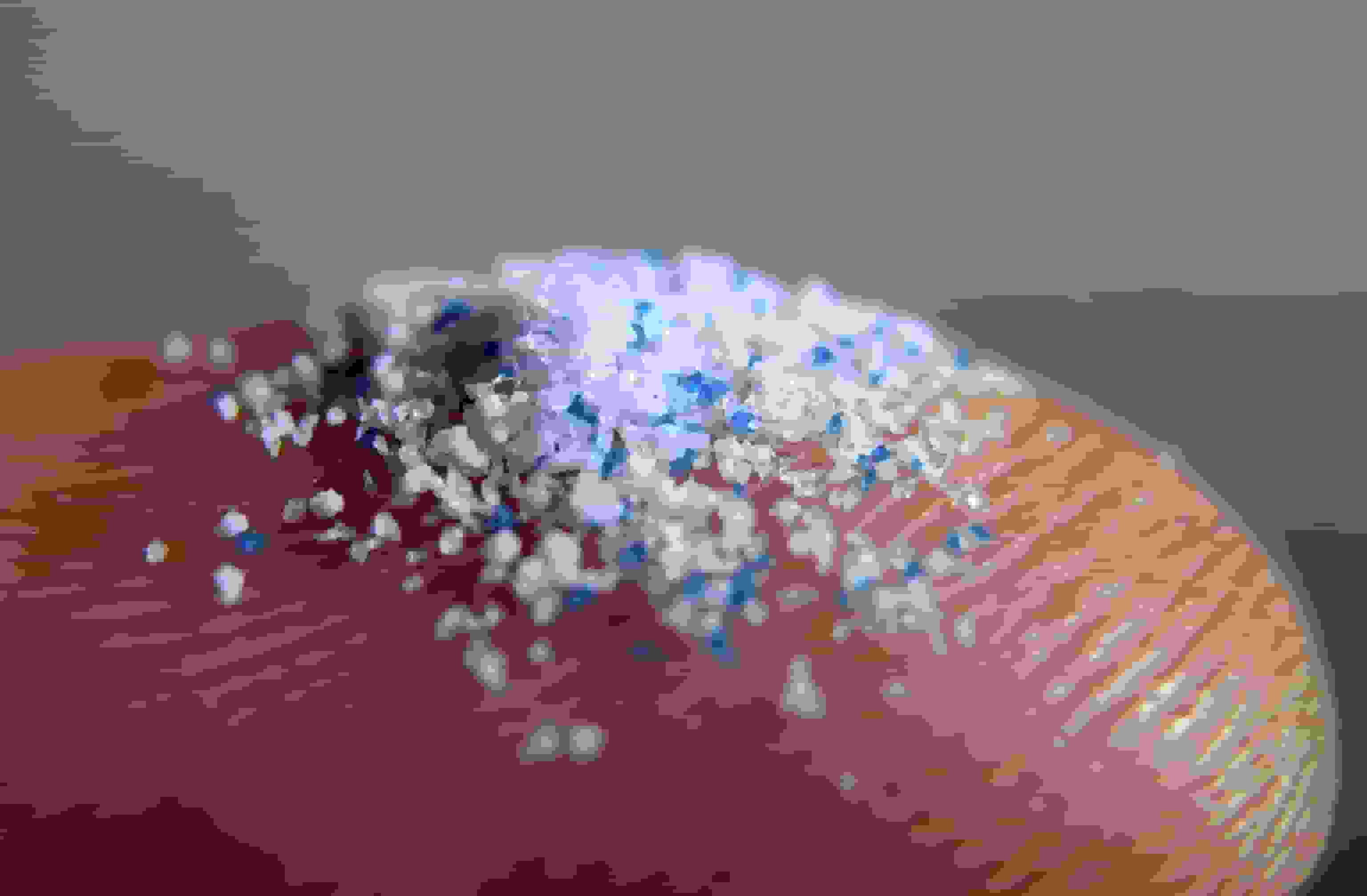 هشدار پزشکان: میکروپلاستیکها میتوانند شریانها را مسدود کنند و باعث سکته شوند